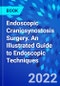 Endoscopic Craniosynostosis Surgery. An Illustrated Guide to Endoscopic Techniques - Product Thumbnail Image