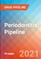 Periodontitis - Pipeline Insight, 2021 - Product Image