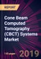 Cone Beam Computed Tomography (CBCT) Systems Market by Product and Geography - Forecast and Analysis 2020-2024 - Product Thumbnail Image