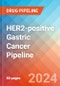 HER2-positive Gastric Cancer - Pipeline Insight, 2024 - Product Image
