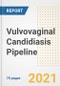 Vulvovaginal Candidiasis Pipeline Drugs and Companies, 2021- Phase, Mechanism of Action, Route, Licensing/Collaboration, Pre-clinical and Clinical Trials - Product Image