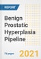 Benign Prostatic Hyperplasia Pipeline Drugs and Companies, 2021- Phase, Mechanism of Action, Route, Licensing/Collaboration, Pre-clinical and Clinical Trials - Product Image