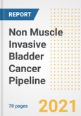 Non Muscle Invasive Bladder Cancer Pipeline Drugs and Companies, 2021- Phase, Mechanism of Action, Route, Licensing/Collaboration, Pre-clinical and Clinical Trials- Product Image
