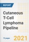 Cutaneous T-Cell Lymphoma Pipeline Drugs and Companies, 2021- Phase, Mechanism of Action, Route, Licensing/Collaboration, Pre-clinical and Clinical Trials - Product Image