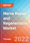 Nerve Repair and Regeneration- Market Insight, Competitive Landscape and Market Forecast- 2027 - Product Image