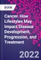 Cancer. How Lifestyles May Impact Disease Development, Progression, and Treatment - Product Thumbnail Image