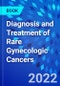 Diagnosis and Treatment of Rare Gynecologic Cancers - Product Thumbnail Image