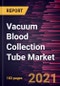 Vacuum Blood Collection Tube Market Forecast to 2028 - COVID-19 Impact and Global Analysis - Product Image