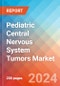 Pediatric Central Nervous System Tumors - Market Insight, Epidemiology and Market Forecast -2032 - Product Thumbnail Image