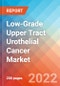 Low-Grade Upper Tract Urothelial Cancer (LG UTUC) - Market Insight, Epidemiology and Market Forecast -2032 - Product Thumbnail Image