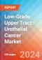 Low-Grade Upper Tract Urothelial Cancer (LG UTUC) - Market Insight, Epidemiology and Market Forecast - 2034 - Product Image