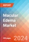 Macular Edema (ME) - Market Insight, Epidemiology and Market Forecast -2032 - Product Thumbnail Image