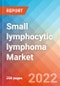 Small lymphocytic lymphoma - Market Insight, Epidemiology and Market Forecast -2032 - Product Thumbnail Image