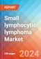 Small lymphocytic lymphoma - Market Insight, Epidemiology and Market Forecast -2032 - Product Thumbnail Image