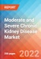 Moderate and Severe Chronic Kidney Disease (CKD) - Market Insight, Epidemiology and Market Forecast -2032 - Product Image