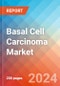 Basal Cell Carcinoma (Basal Cell Epithelioma) - Market Insight, Epidemiology and Market Forecast - 2032 - Product Image