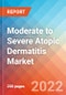 Moderate to Severe Atopic Dermatitis (AD) - Market Insight, Epidemiology and Market Forecast -2032 - Product Thumbnail Image