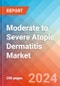 Moderate to Severe Atopic Dermatitis (AD) - Market Insight, Epidemiology and Market Forecast -2032 - Product Image