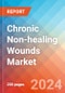 Chronic Non-healing Wounds - Market Insight, Epidemiology and Market Forecast -2032 - Product Thumbnail Image