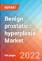 Benign prostatic hyperplasia (BPH) - Market Insight, Epidemiology and Market Forecast -2032 - Product Thumbnail Image