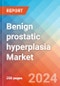 Benign prostatic hyperplasia (BPH) - Market Insight, Epidemiology and Market Forecast -2032 - Product Thumbnail Image