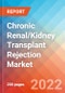 Chronic Renal/Kidney Transplant Rejection - Market Insight, Epidemiology and Market Forecast -2032 - Product Image