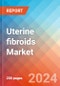 Uterine fibroids - Market Insight, Epidemiology and Market Forecast -2032 - Product Thumbnail Image