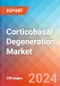 Corticobasal Degeneration (CBD) - Market Insight, Epidemiology and Market Forecast -2032 - Product Thumbnail Image