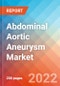 Abdominal Aortic Aneurysm - Market Insight, Epidemiology and Market Forecast -2032 - Product Image