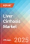 Liver Cirrhosis - Market Insight, Epidemiology and Market Forecast -2032 - Product Thumbnail Image