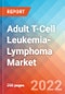 Adult T-Cell Leukemia-Lymphoma - Market Insight, Epidemiology and Market Forecast -2032 - Product Image