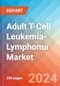 Adult T-Cell Leukemia-Lymphoma - Market Insight, Epidemiology and Market Forecast -2032 - Product Thumbnail Image