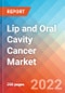 Lip and Oral Cavity Cancer - Market Insight, Epidemiology and Market Forecast -2032 - Product Image