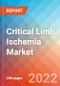 Critical Limb Ischemia - Market Insight, Epidemiology and Market Forecast -2032 - Product Image