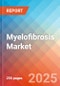 Myelofibrosis (MF) - Market Insight, Epidemiology and Market Forecast - 2034 - Product Thumbnail Image