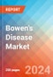 Bowen's Disease - Market Insight, Epidemiology and Market Forecast -2032 - Product Thumbnail Image