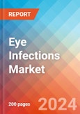 Eye Infections - Market Insight, Epidemiology and Market Forecast -2032- Product Image