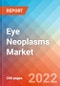 Eye Neoplasms - Market Insight, Epidemiology and Market Forecast -2032 - Product Thumbnail Image