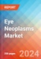 Eye Neoplasms - Market Insight, Epidemiology and Market Forecast -2032 - Product Thumbnail Image