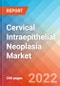 Cervical Intraepithelial Neoplasia - Market Insight, Epidemiology and Market Forecast -2032 - Product Image