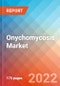 Onychomycosis - Market Insight, Epidemiology And Market Forecast - 2032 - Product Image