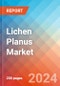 Lichen Planus - Market Insight, Epidemiology and Market Forecast -2032 - Product Thumbnail Image