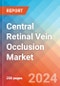 Central Retinal Vein Occlusion - Market Insight, Epidemiology and Market Forecast - 2034 - Product Image