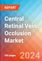 Central Retinal Vein Occlusion - Market Insight, Epidemiology and Market Forecast -2032 - Product Thumbnail Image