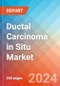 Ductal Carcinoma in Situ - Market Insight, Epidemiology and Market Forecast -2032 - Product Thumbnail Image