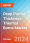 Deep Partial-Thickness Thermal Burns - Market Insight, Epidemiology and Market Forecast - 2034 - Product Thumbnail Image