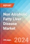 Non Alcoholic Fatty Liver Disease (NAFLD) - Market Insight, Epidemiology and Market Forecast - 2034 - Product Thumbnail Image