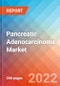 Pancreatic Adenocarcinoma - Market Insight, Epidemiology and Market Forecast -2032 - Product Thumbnail Image