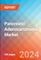 Pancreatic Adenocarcinoma - Market Insight, Epidemiology and Market Forecast -2032 - Product Thumbnail Image