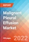 Malignant Pleural Effusion - Market Insight, Epidemiology and Market Forecast -2032 - Product Image